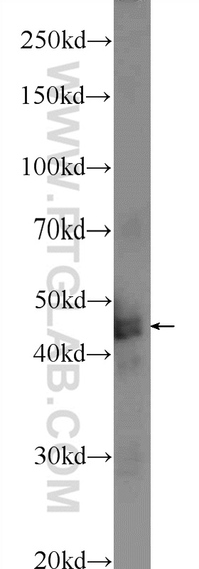 TMEM201 Polyclonal antibody