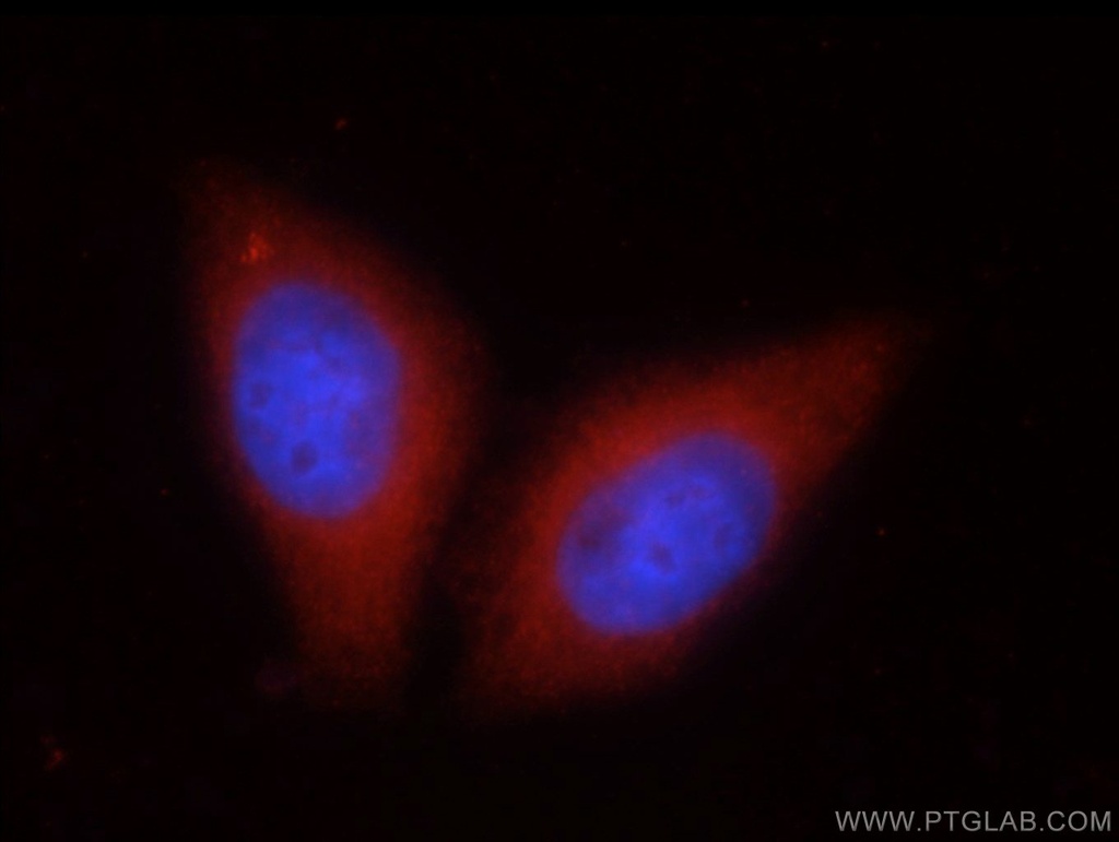SIL1 Polyclonal antibody