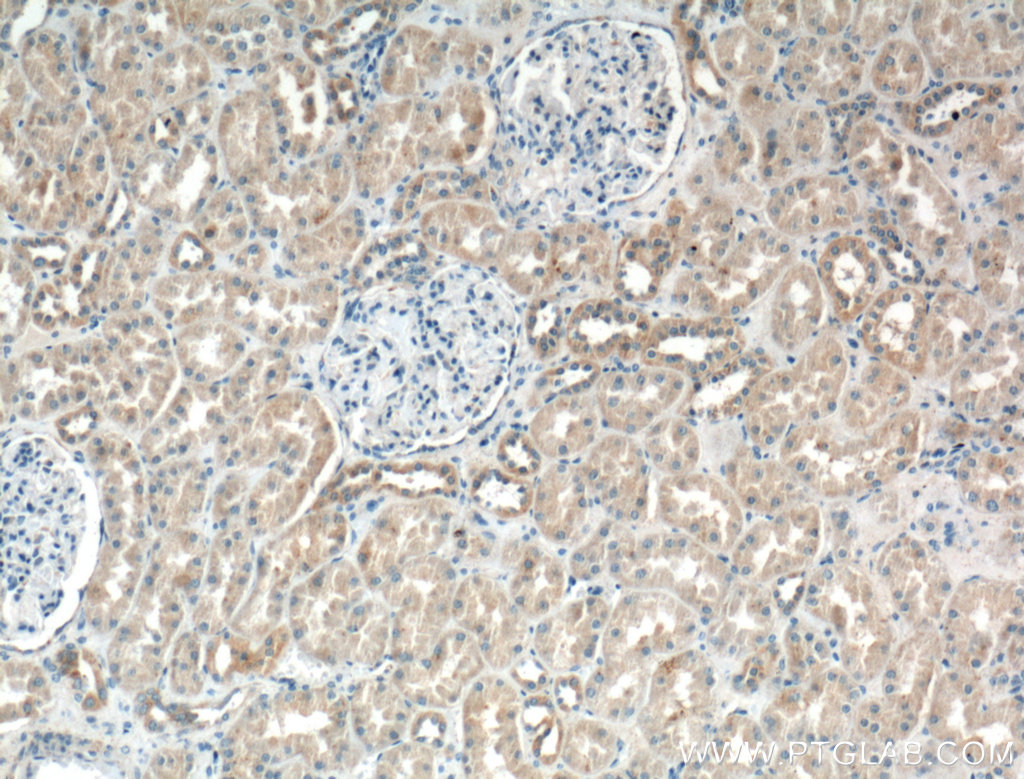 Cd2ap Polyclonal antibody