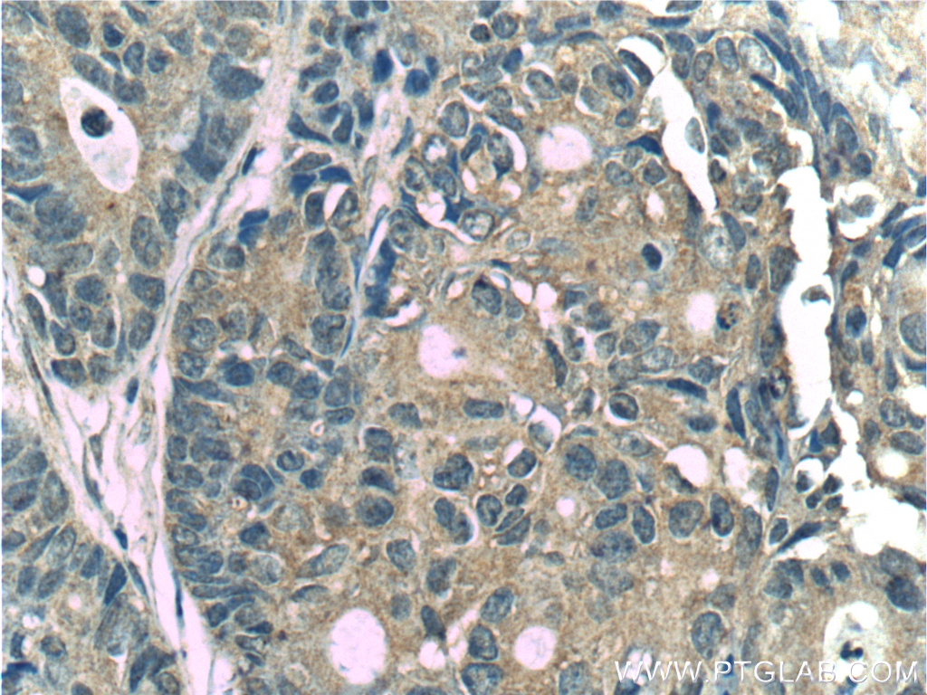 CYS1 Polyclonal antibody
