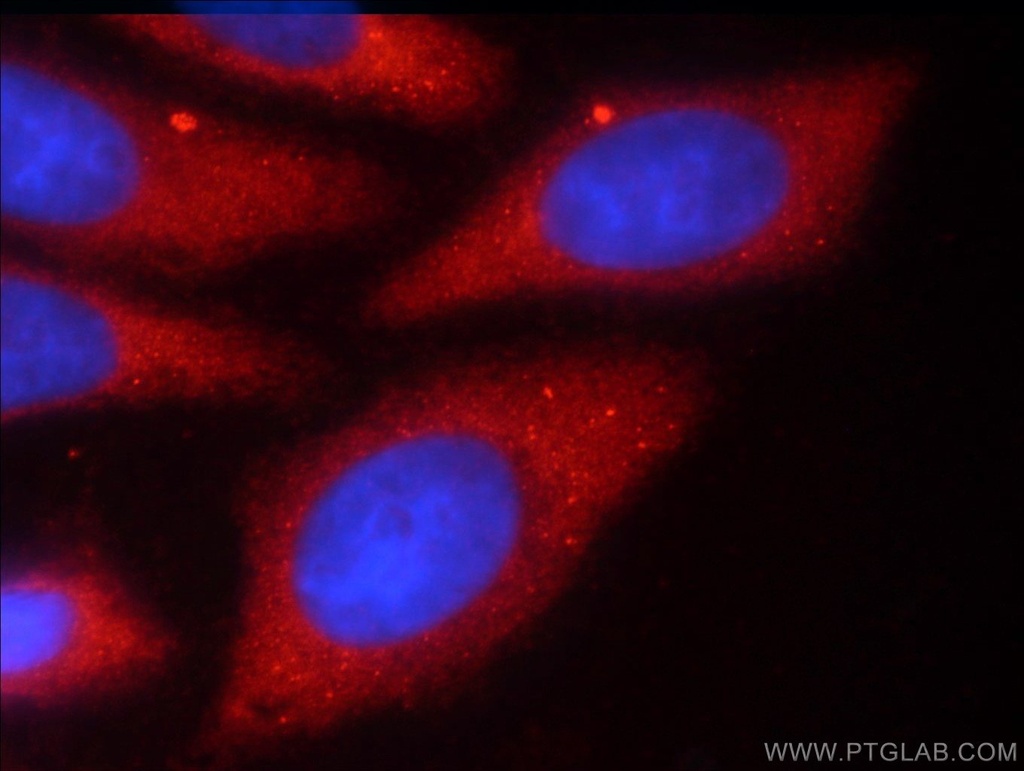 TMEM59 Polyclonal antibody