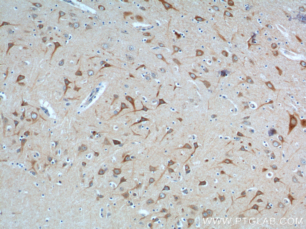 NPBWR2 Polyclonal antibody