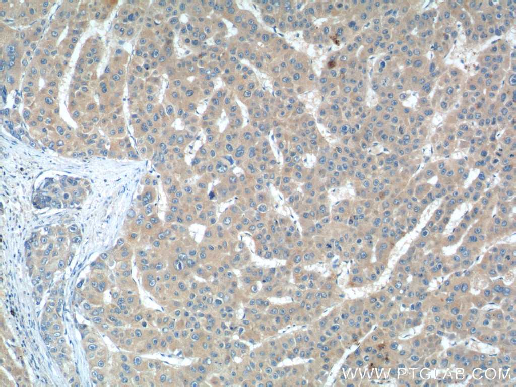IL-27 Polyclonal antibody