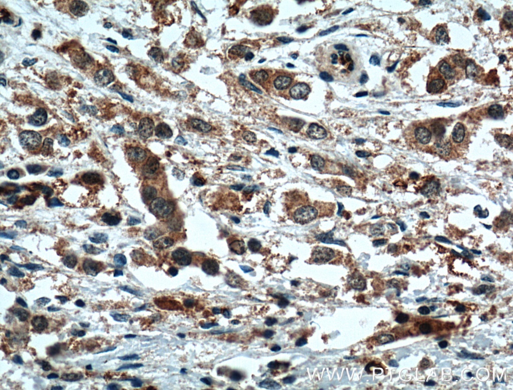 XBP1S/XBP1U Polyclonal antibody