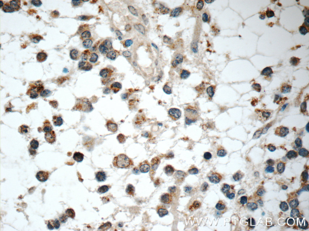 IL-1F6/IL-36 Alpha Polyclonal antibody