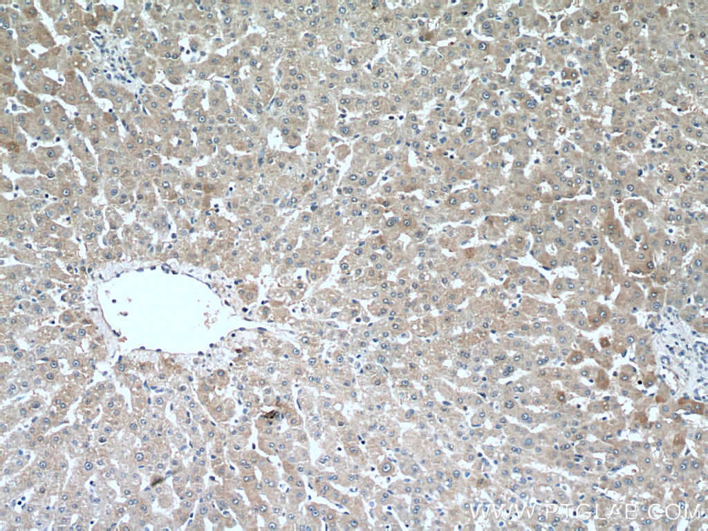CRP Polyclonal antibody