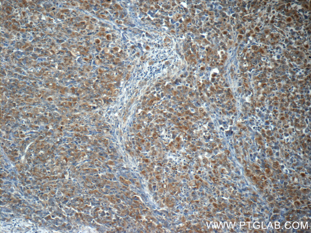 ALK/CD246 Polyclonal antibody