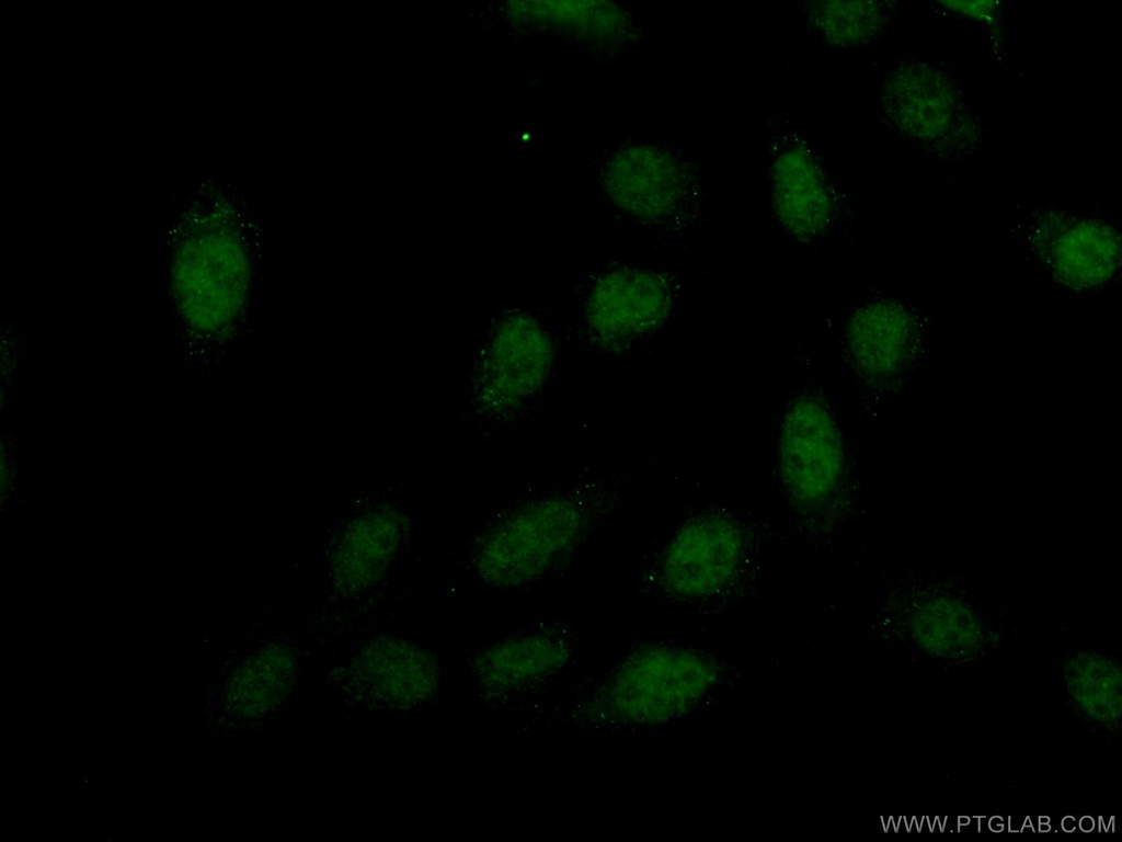 PREX2 Polyclonal antibody