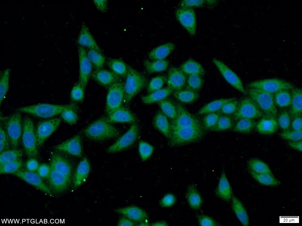 ANKRD55 Polyclonal antibody