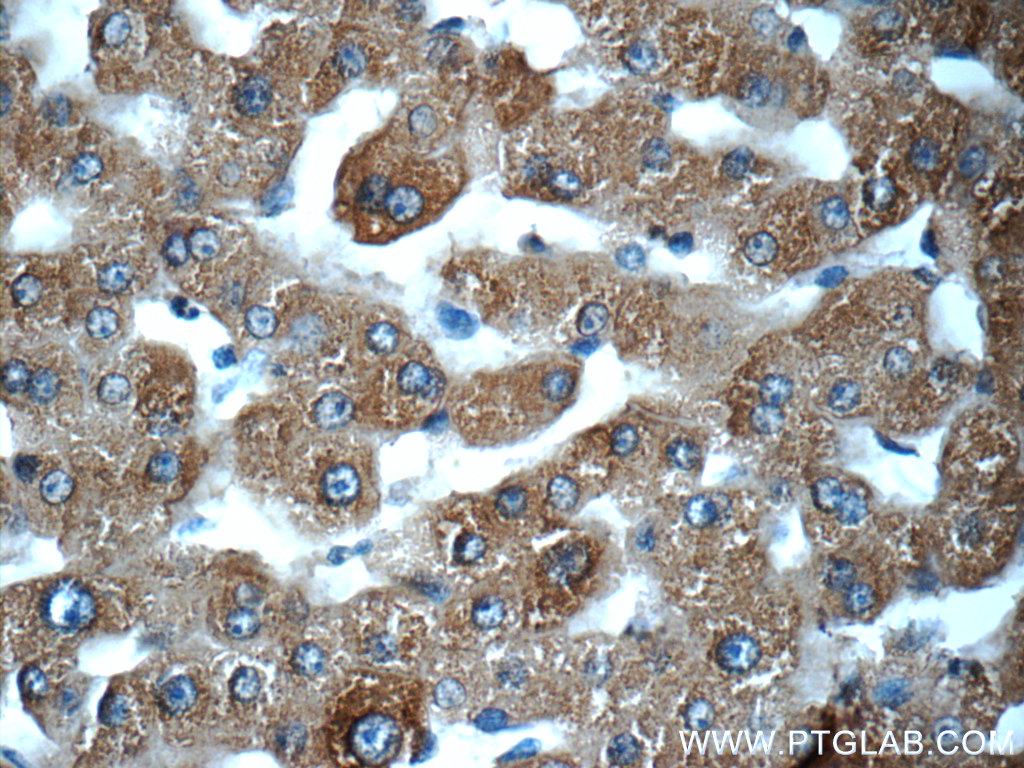 MBL2 Polyclonal antibody