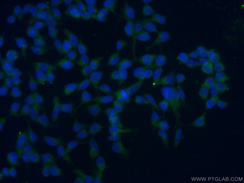 TAF15 Polyclonal antibody