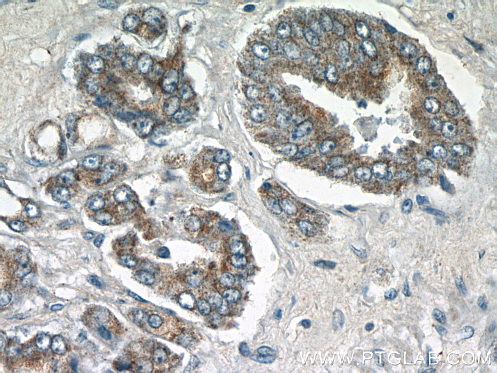 STAC2 Polyclonal antibody