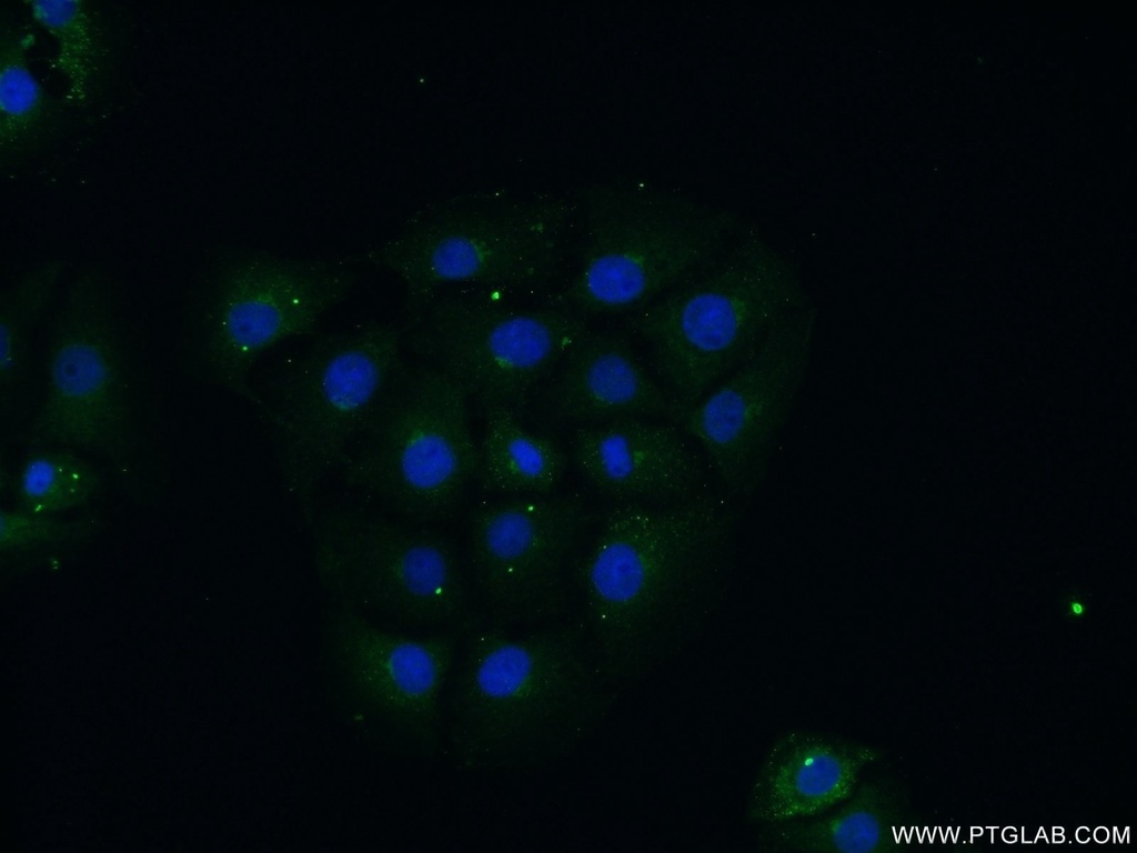 FBXO28 Polyclonal antibody