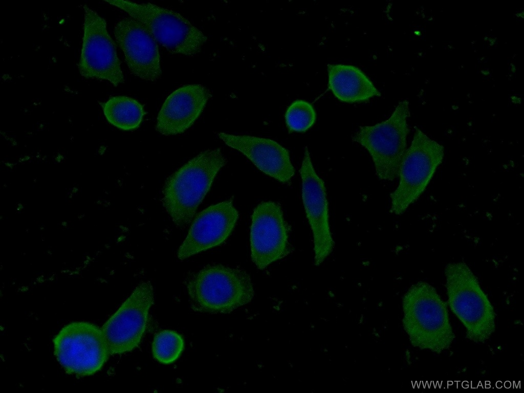 FAM71F2 Polyclonal antibody