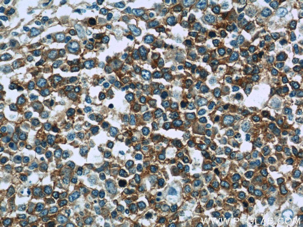 RFTN1 Polyclonal antibody