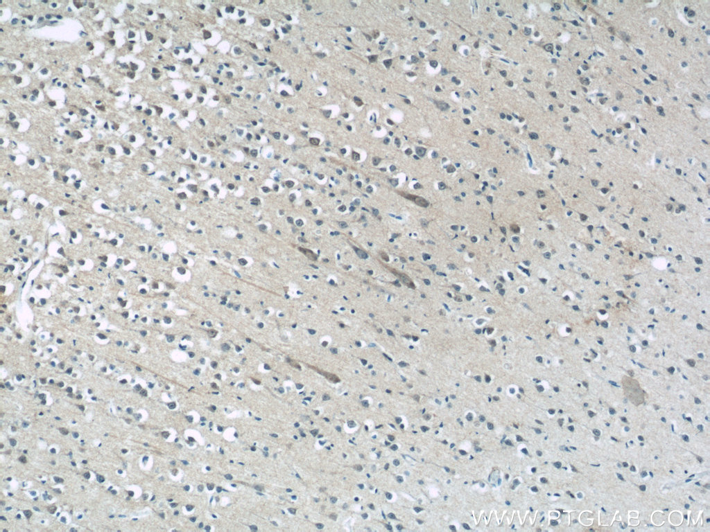 MFSD8 Polyclonal antibody