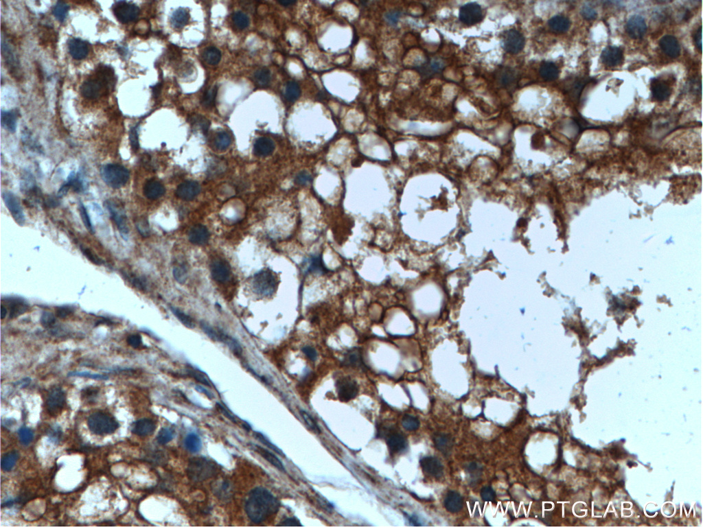 LIPI Polyclonal antibody