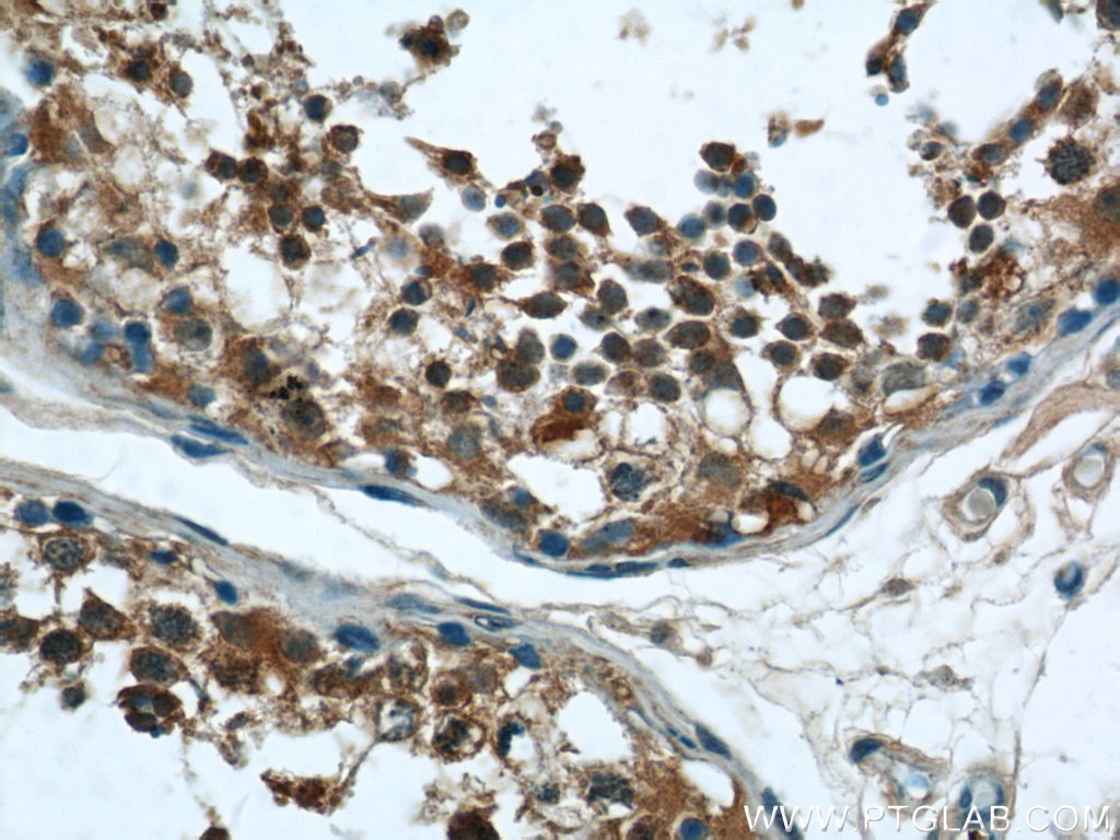 RNF17 Polyclonal antibody