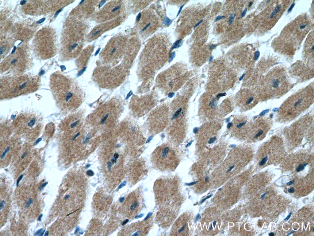 MYLK4 Polyclonal antibody