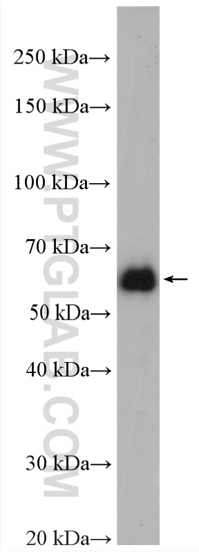 EEPD1 Polyclonal antibody