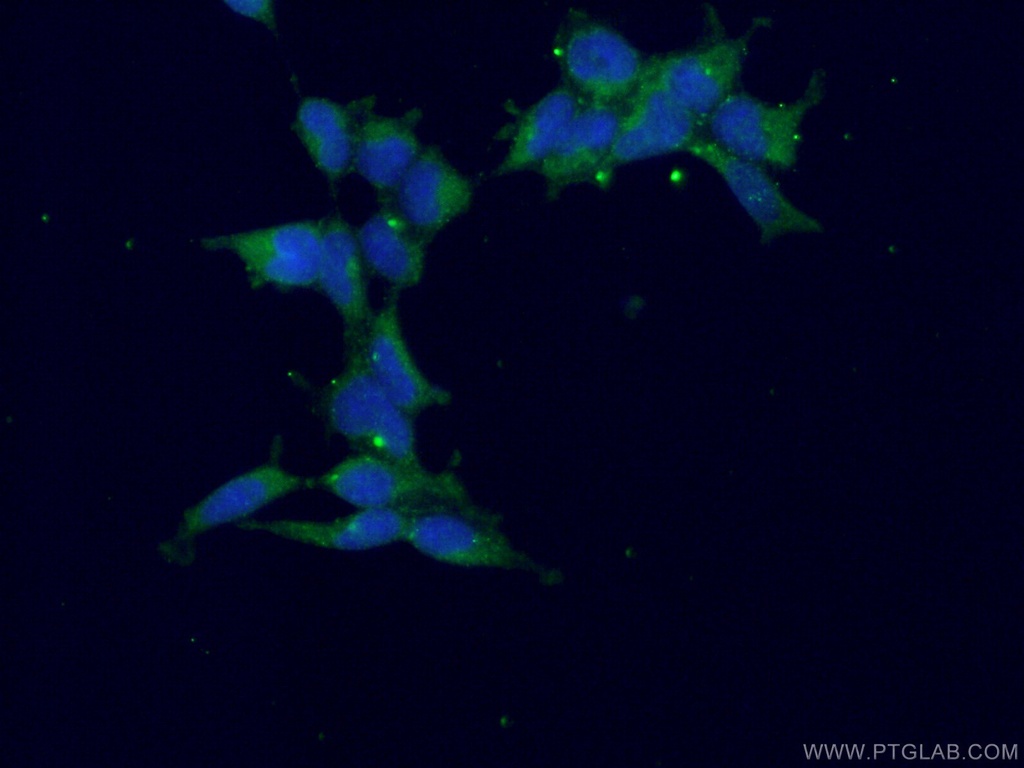 CAMK1 Polyclonal antibody