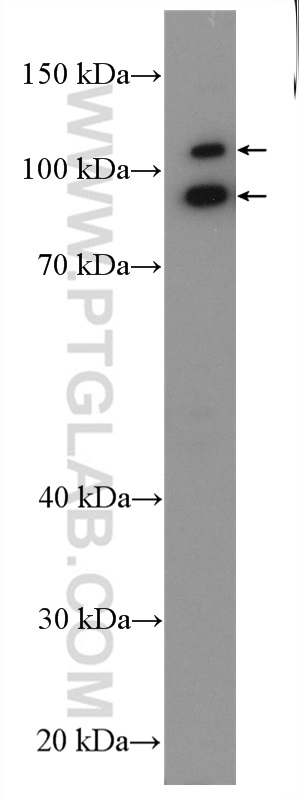 ABTB2 Polyclonal antibody