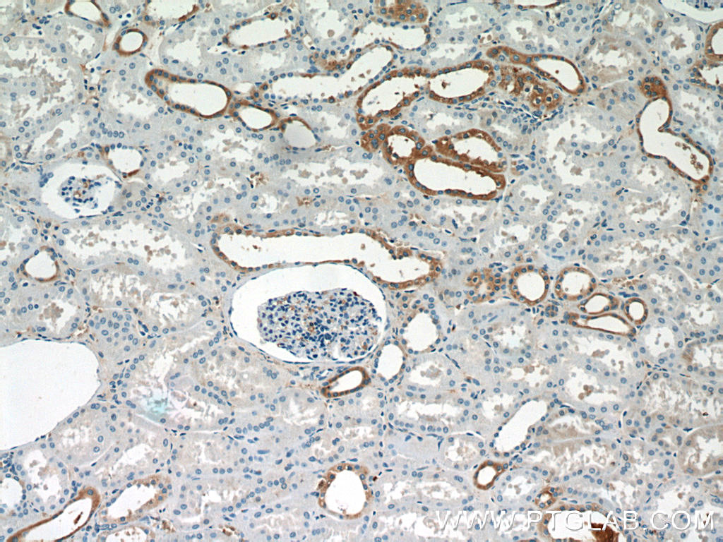 SGLT3/SLC5A4 Polyclonal antibody