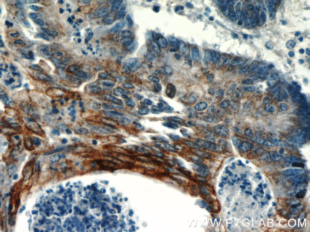 TMEM9B Polyclonal antibody