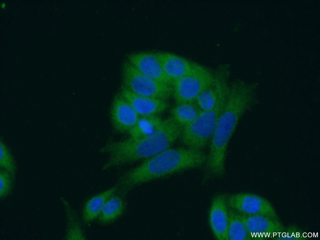 ANKRD16 Polyclonal antibody