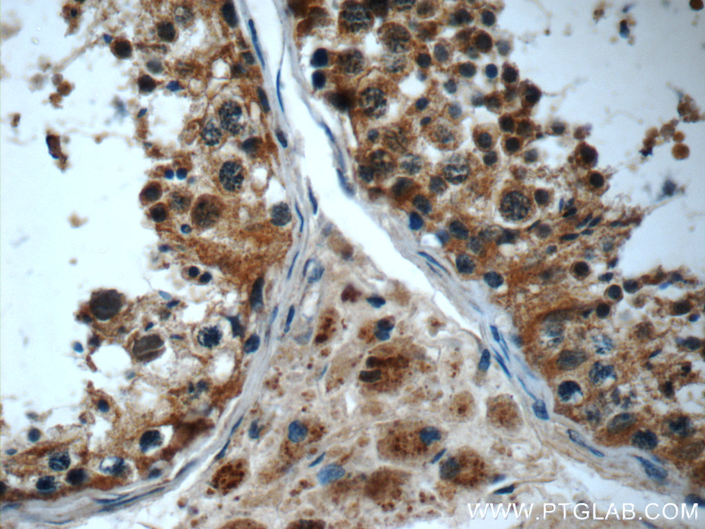 IFT43 Polyclonal antibody