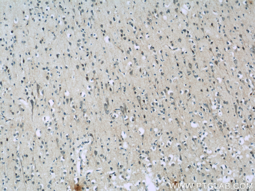 AQR Polyclonal antibody