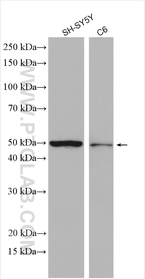 UGT2A1 Polyclonal antibody