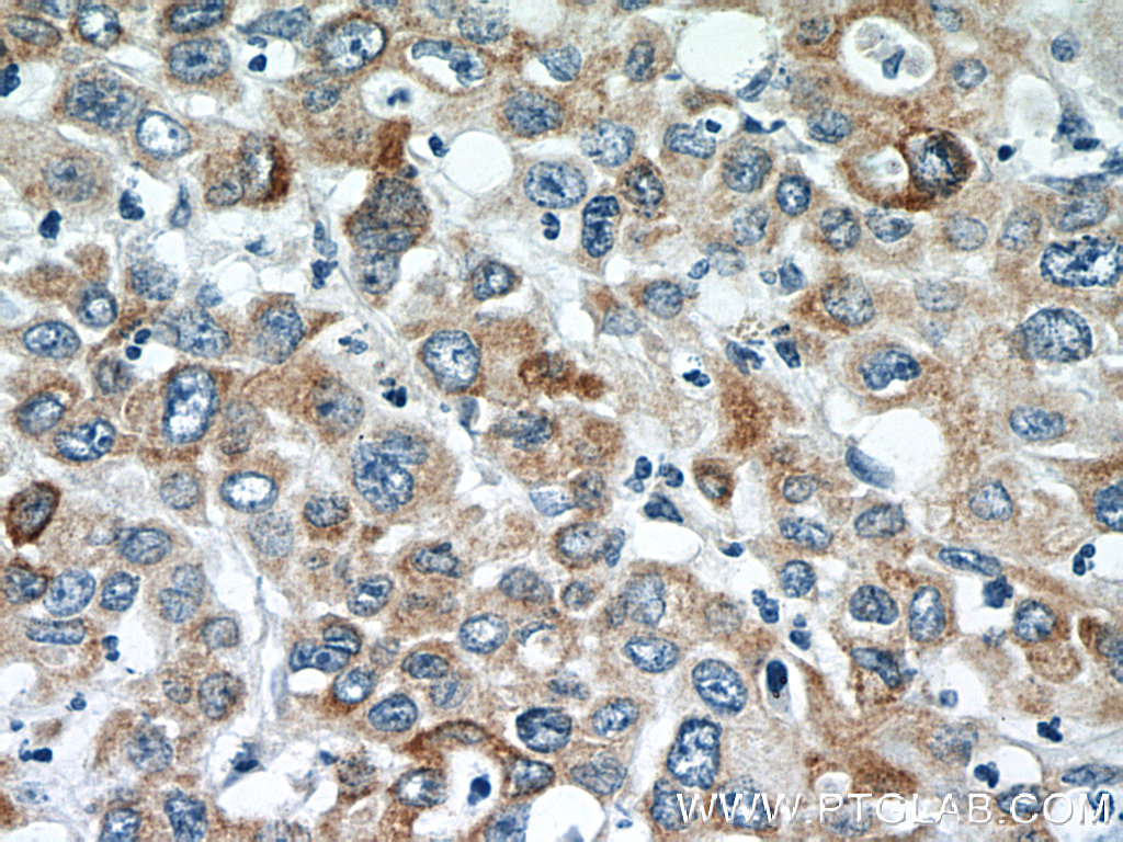 TMEM25 Polyclonal antibody