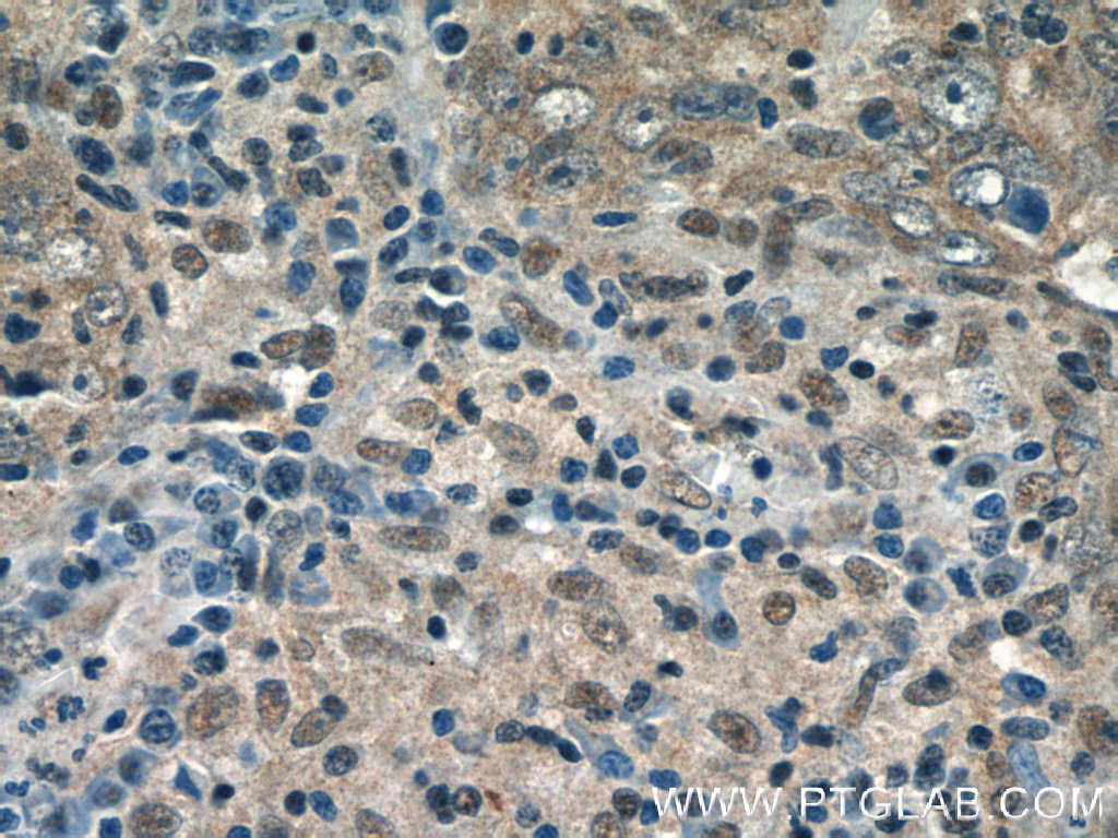 GPATCH2 Polyclonal antibody