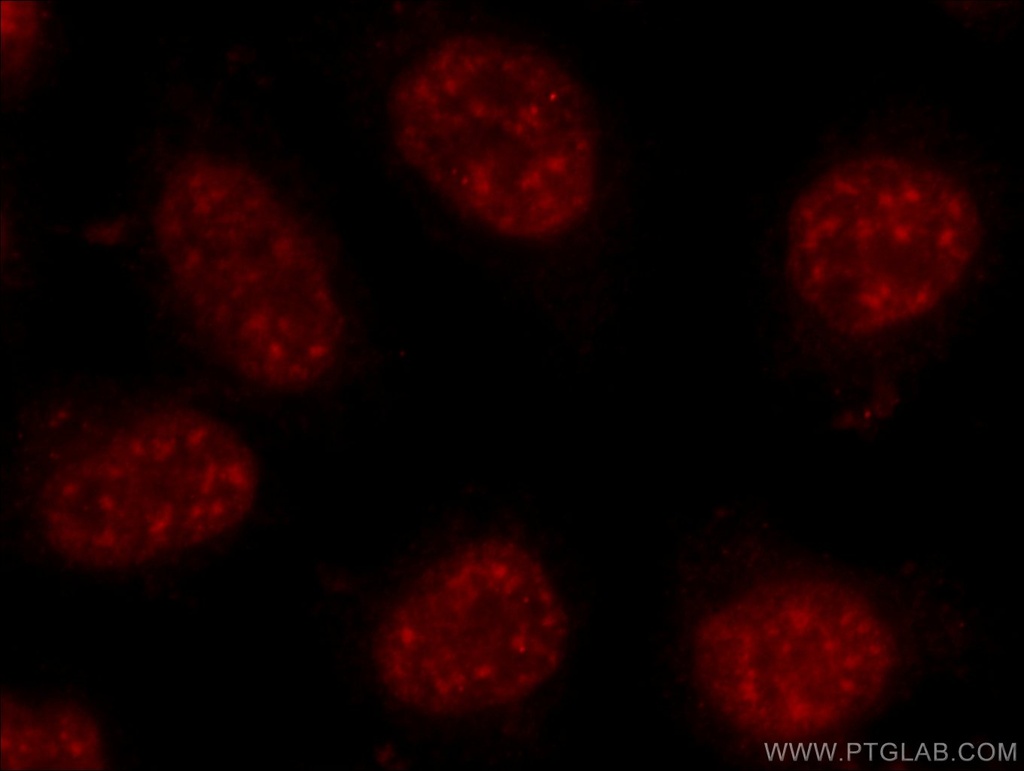 C17orf85 Polyclonal antibody