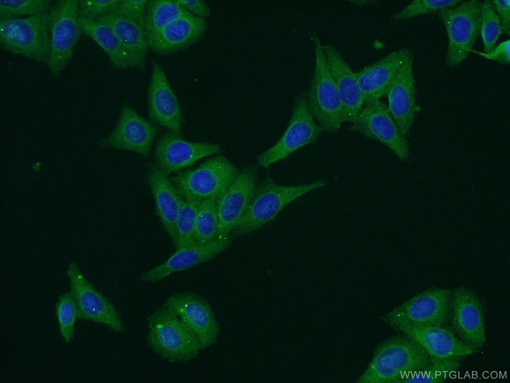 PERK/EIF2AK3 Polyclonal antibody