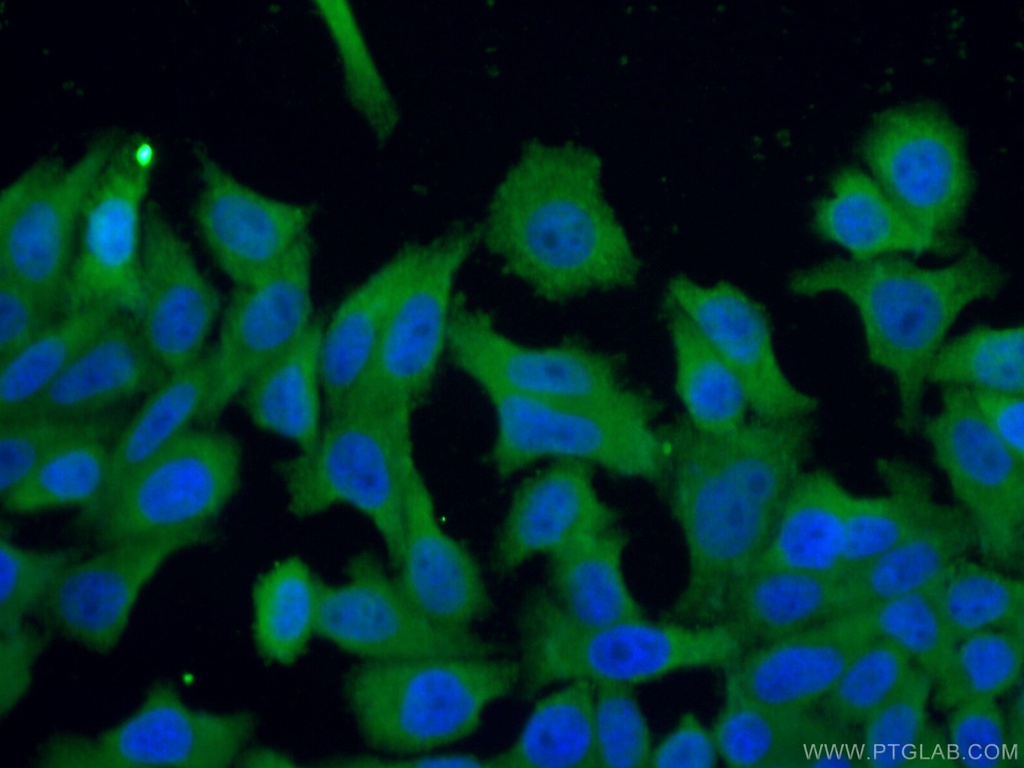 TRIM16 Polyclonal antibody