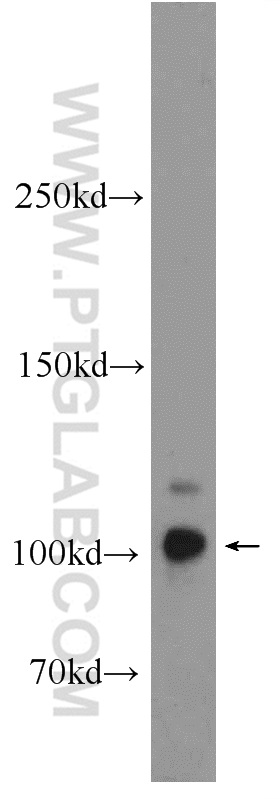 MICALL2 Polyclonal antibody