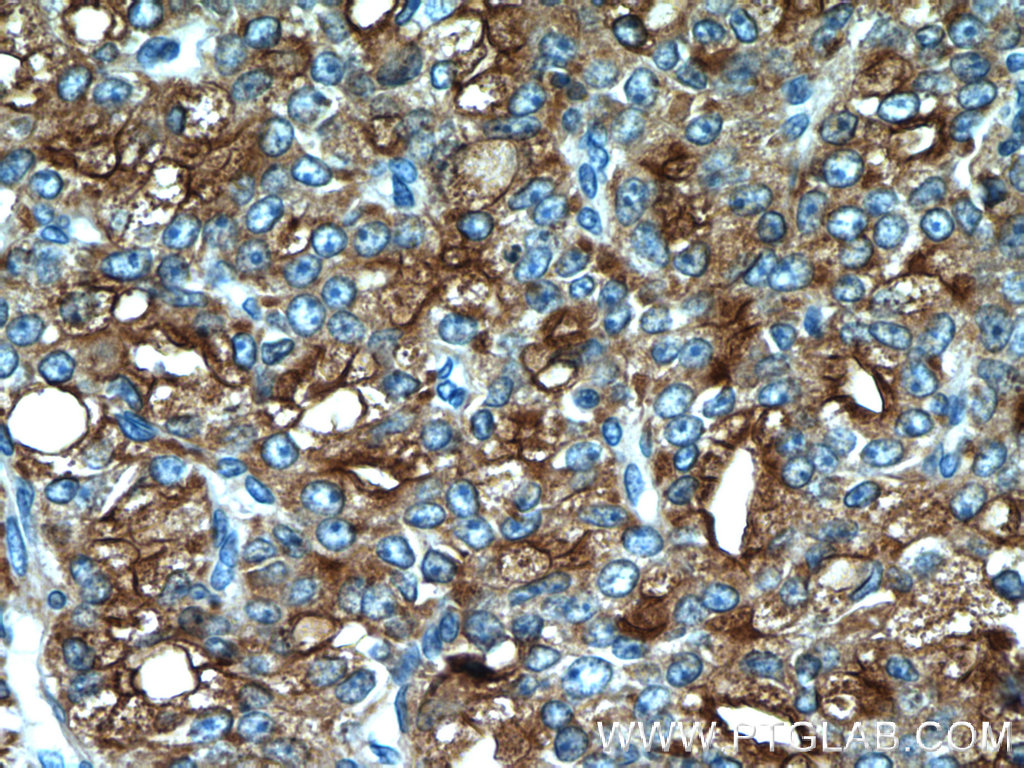 ACPP Polyclonal antibody