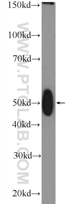 TFB2M Polyclonal antibody