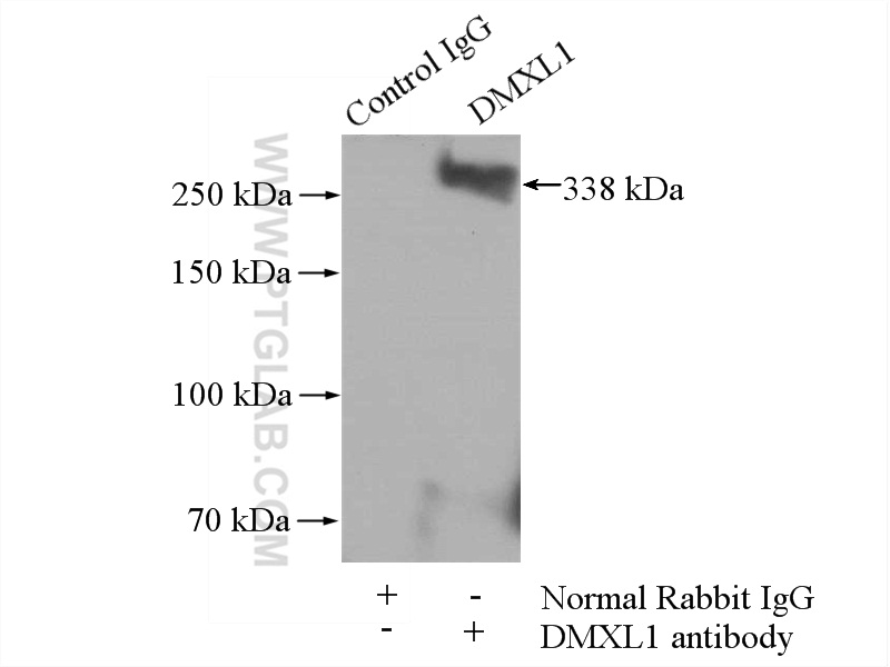 DMXL1 Polyclonal antibody