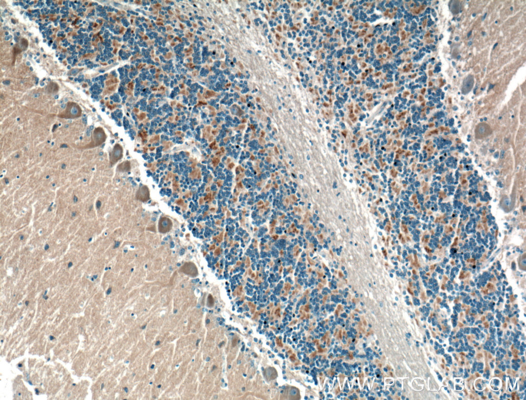 DMXL2 Polyclonal antibody