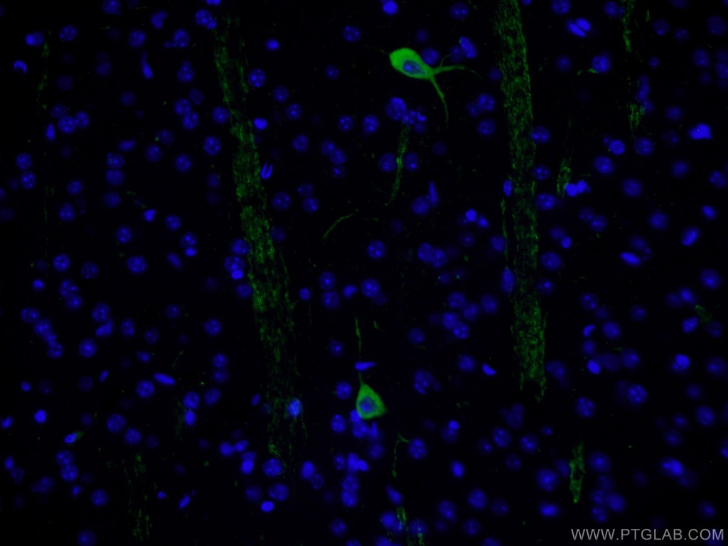 CHAT Polyclonal antibody