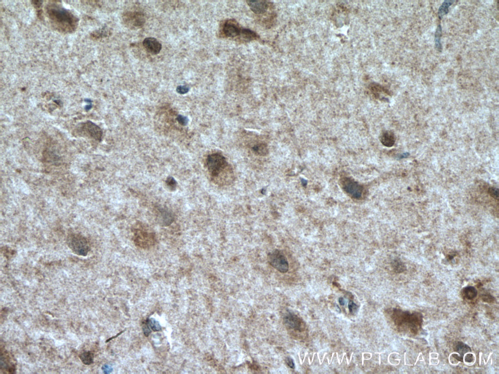 TALPID3 Polyclonal antibody