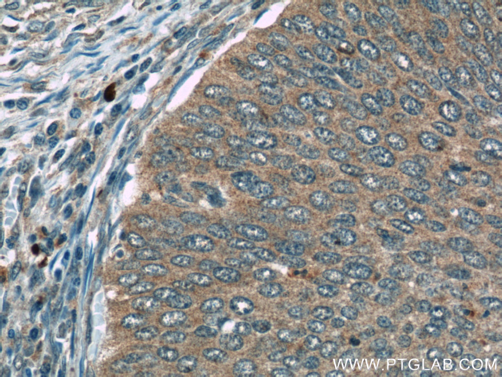 FAM168B Polyclonal antibody