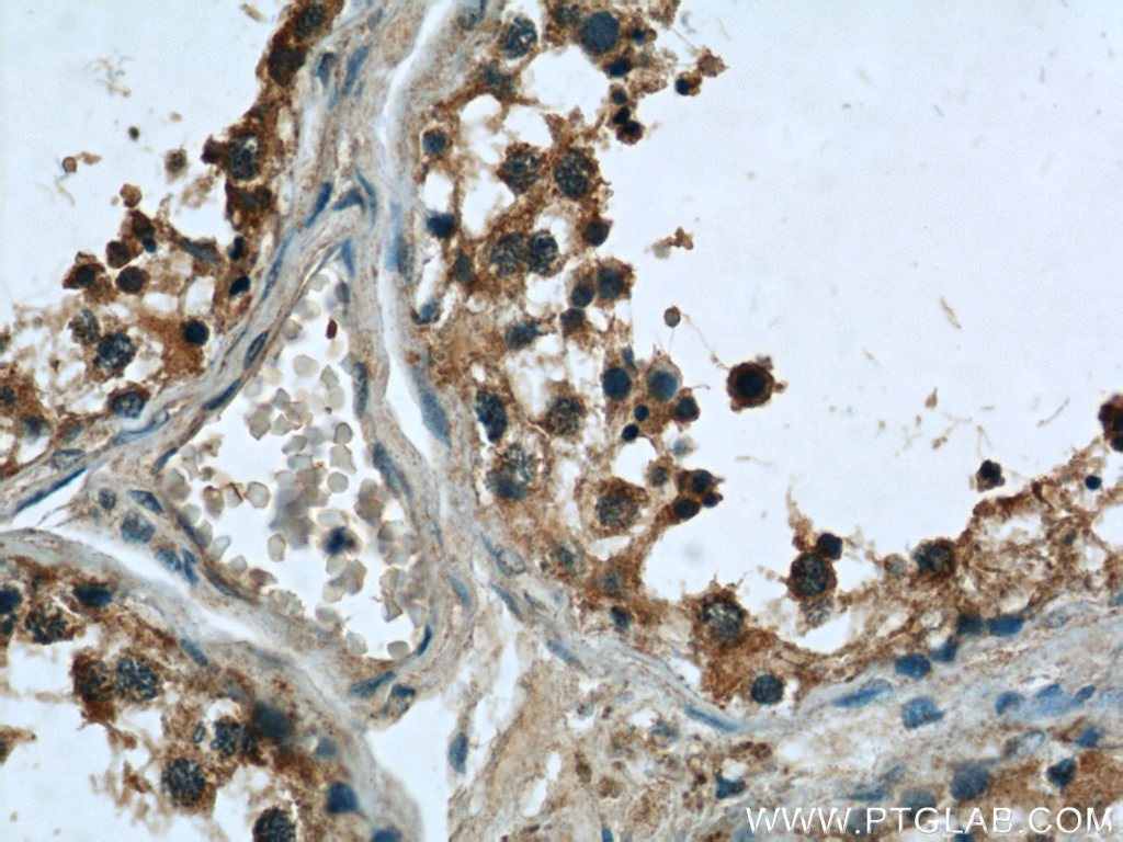 TEX38 Polyclonal antibody
