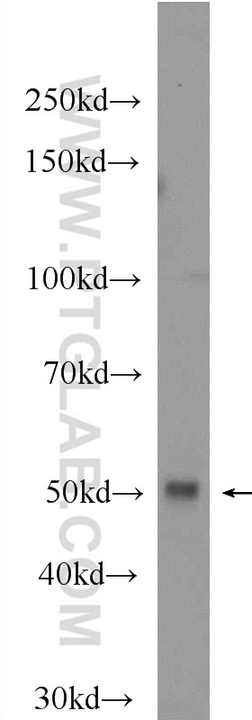 IRF8 Polyclonal antibody