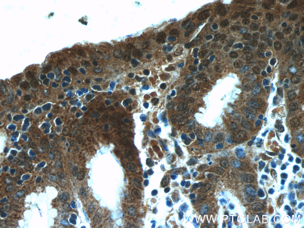 NUP205 Polyclonal antibody