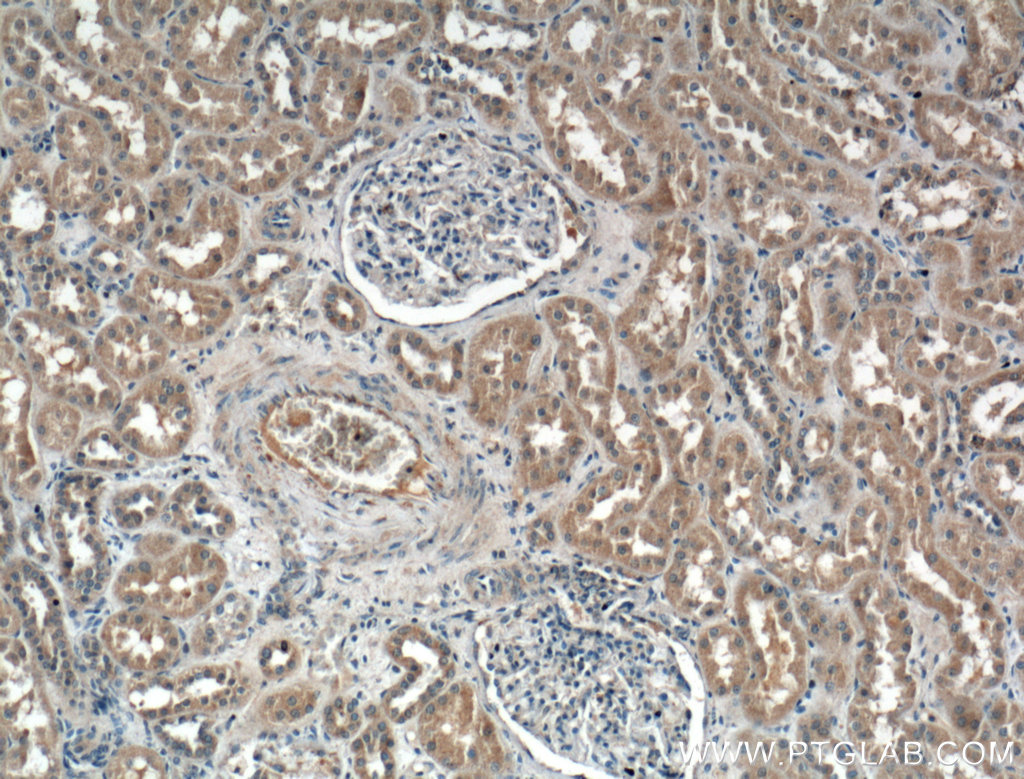 CCBE1 Polyclonal antibody