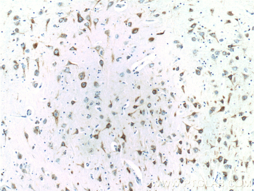 EPHA6 Polyclonal antibody